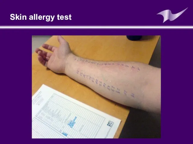 Skin allergy test