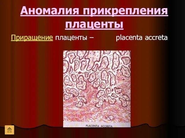 Аномалия прикрепления плаценты Приращение плаценты – placenta accreta