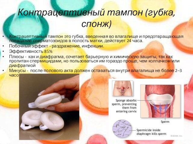 Контрацептивный тампон (губка, спонж) Контрацептивный тампон это губка, введенная во влагалище и предотвращающая попадание сперматозоидов в полость