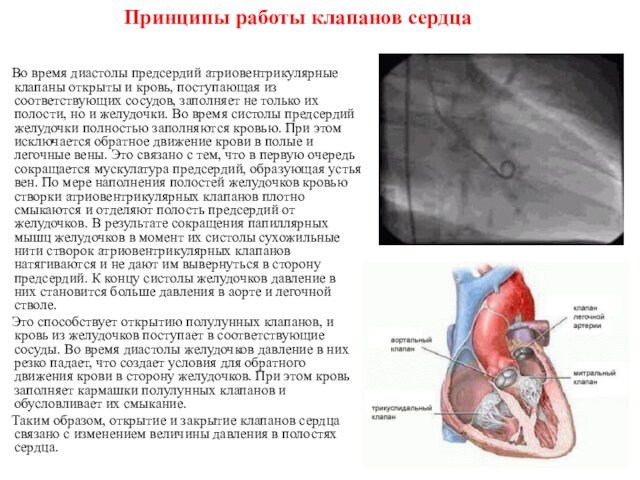 Принципы работы клапанов сердца  Во время диастолы