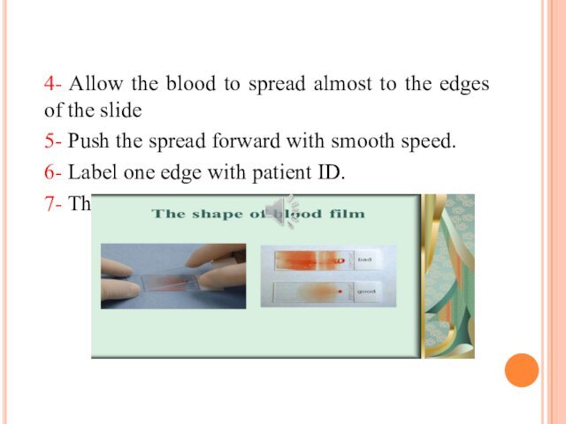 4- Allow the blood to spread almost to the edges of the slide5- Push the spread