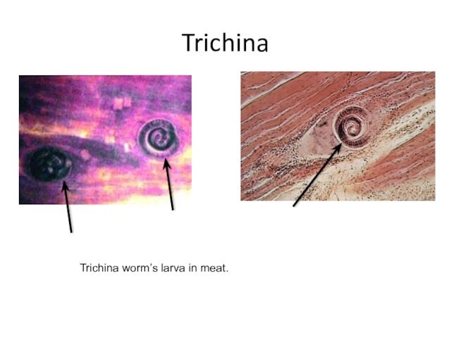TrichinaTrichina worm’s larva in meat.