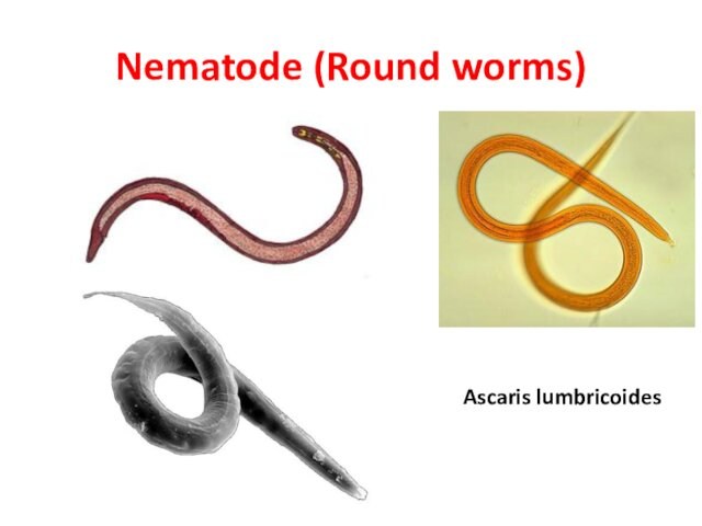 Nematode (Round worms)Ascaris lumbricoides