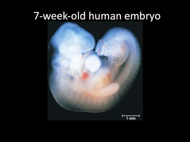 7-week-old human embryo
