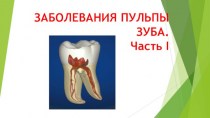 Заболевания пульпы зуба. Часть I