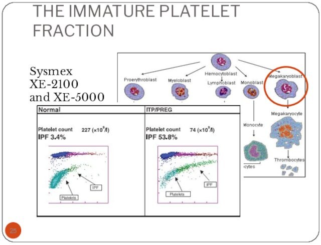 THE IMMATURE PLATELET FRACTIONSysmex XE-2100 and XE-5000
