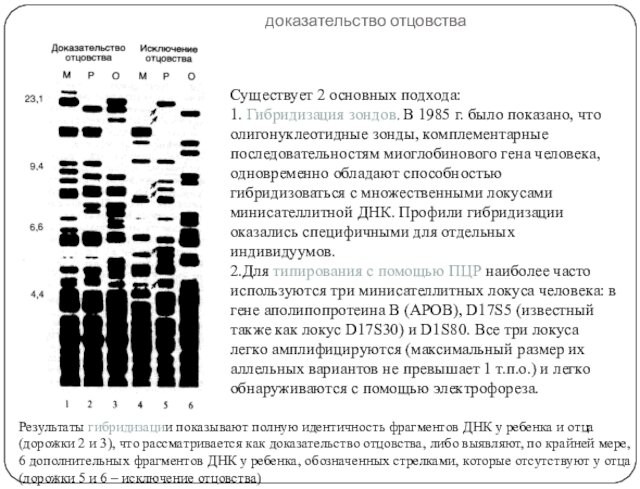 доказательство отцовства Результаты гибридизации показывают полную идентичность фрагментов ДНК у ребенка и отца (дорожки 2
