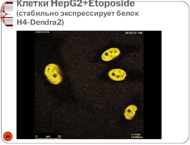 Клетки HepG2+Etoposide (стабильно экспрессирует белок H4-Dendra2)