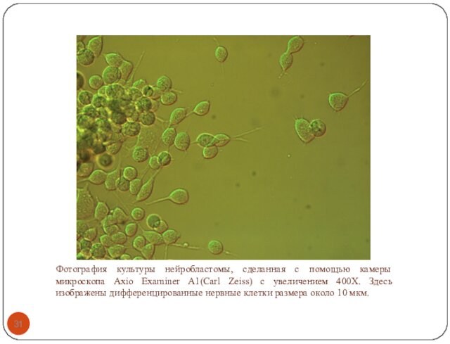 Фотография культуры нейробластомы, сделанная с помощью камеры микроскопа Axio Examiner A1(Carl Zeiss) с увеличением 400Х.