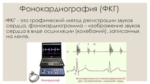 Фонокардиография (ФКГ)ФКГ - это графический метод регистрации звуков сердца, фонокардиограмма – изображение звуков сердца в