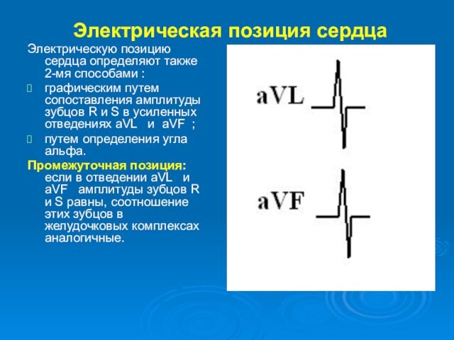 Электрическая позиция сердцаЭлектрическую позицию сердца определяют также 2-мя способами : графическим путем сопоставления амплитуды