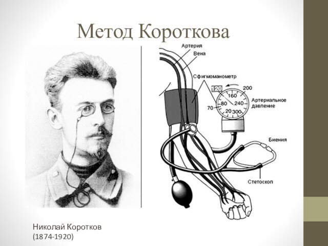 Метод Короткова Николай Коротков (1874-1920)