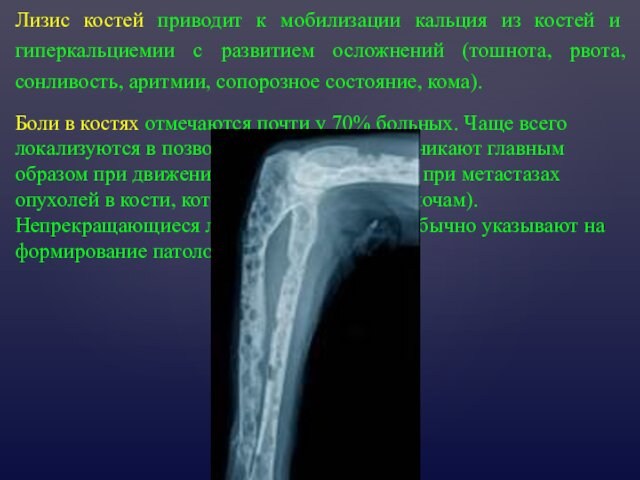 Лизис костей приводит к мобилизации кальция из костей и гиперкальциемии с развитием осложнений (тошнота, рвота,