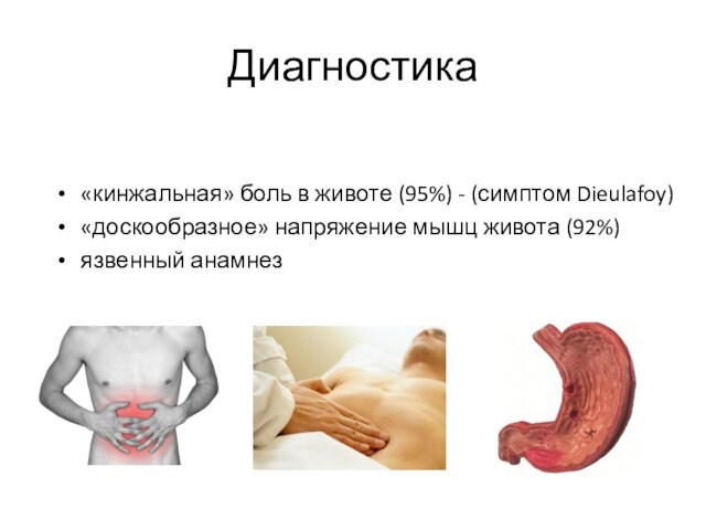Диагностика«кинжальная» боль в животе (95%) - (симптом Dieulafoy) «доскообразное» напряжение мышц живота (92%)язвенный анамнез