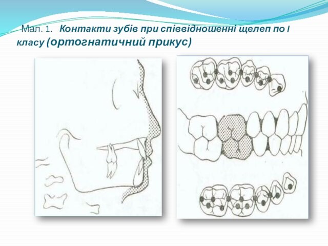 Мал. 1. Контакти зубів при співвідношенні щелеп по I класу (ортогнатичний прикус)