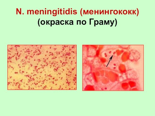 N. meningitidis (менингококк)  (окраска по Граму)