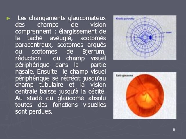 Les changements glaucomateux des champs de vision comprennent : élargissement de la tache aveugle,