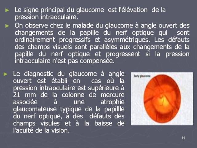 Le diagnostic du glaucome à angle ouvert est établi en cas où la pression intraoculaire