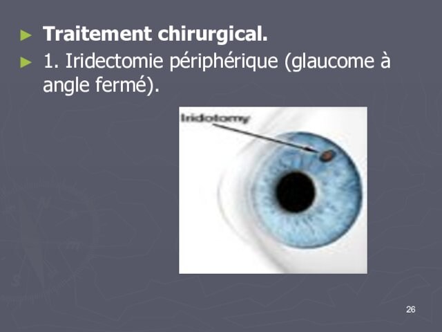 Traitement chirurgical.1. Iridectomie périphérique (glaucome à angle fermé).