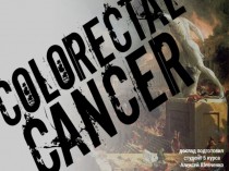 Колоректальный рак