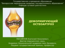 Деформирующий остеоартроз