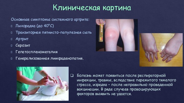 Клиническая картина Основные симптомы системного артрита: Лихорадка (до 40°С)  Транзиторная пятнисто-папулезная сыпь Артрит Серозит