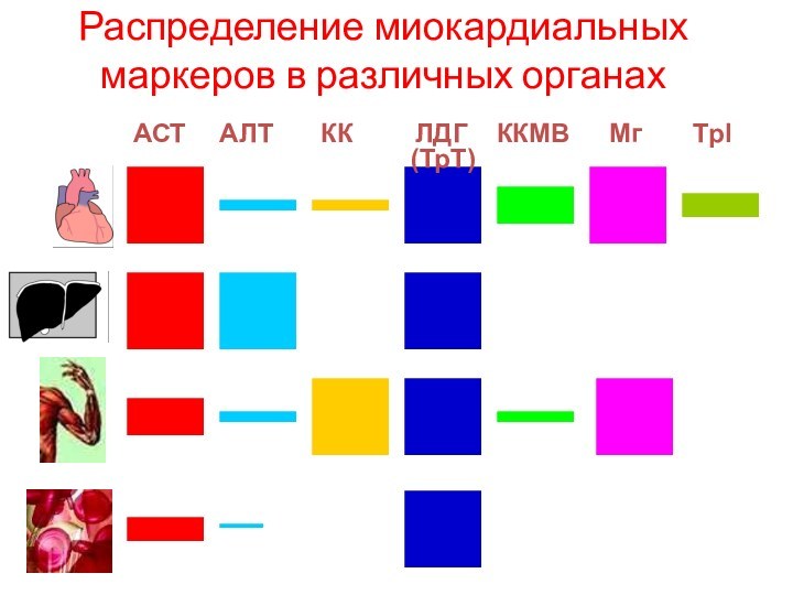 Распределение миокардиальных маркеров в различных органахАСТ	 АЛТ	 КК	  ЛДГ ККМВ	Мг  ТрI 							(ТрТ)
