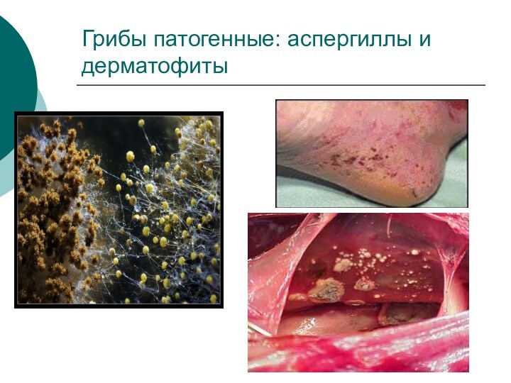 Грибы патогенные: аспергиллы и дерматофиты