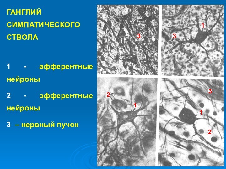 ГАНГЛИЙ СИМПАТИЧЕСКОГО СТВОЛА  1 - афферентные нейроны 2 - эфферентные нейроны 3 – нервный