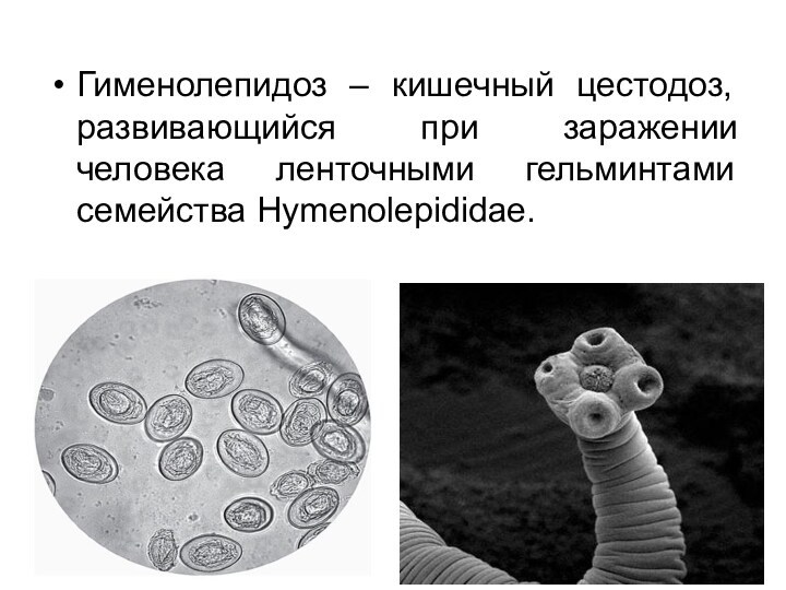 Гименолепидоз – кишечный цестодоз, развивающийся при заражении человека ленточными гельминтами семейства Hymenolepididae.