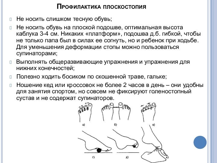 Профилактика плоскостопияНе носить слишком тесную обувь;Не носить обувь на плоской подошве, оптимальная высота каблука 3-4