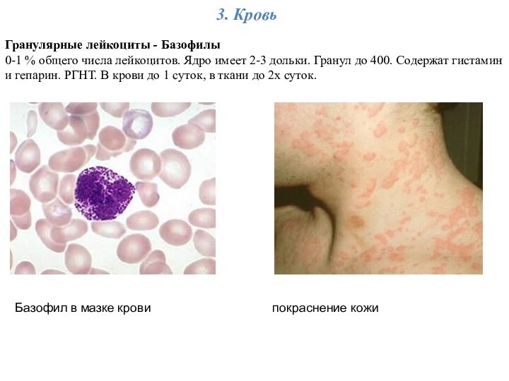 3. КровьГранулярные лейкоциты - Базофилы 0-1 % общего числа лейкоцитов. Ядро имеет 2-3 дольки. Гранул