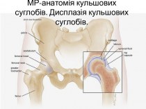 МР-анатомія кульшових суглобів. Дисплазія кульшових суглобів